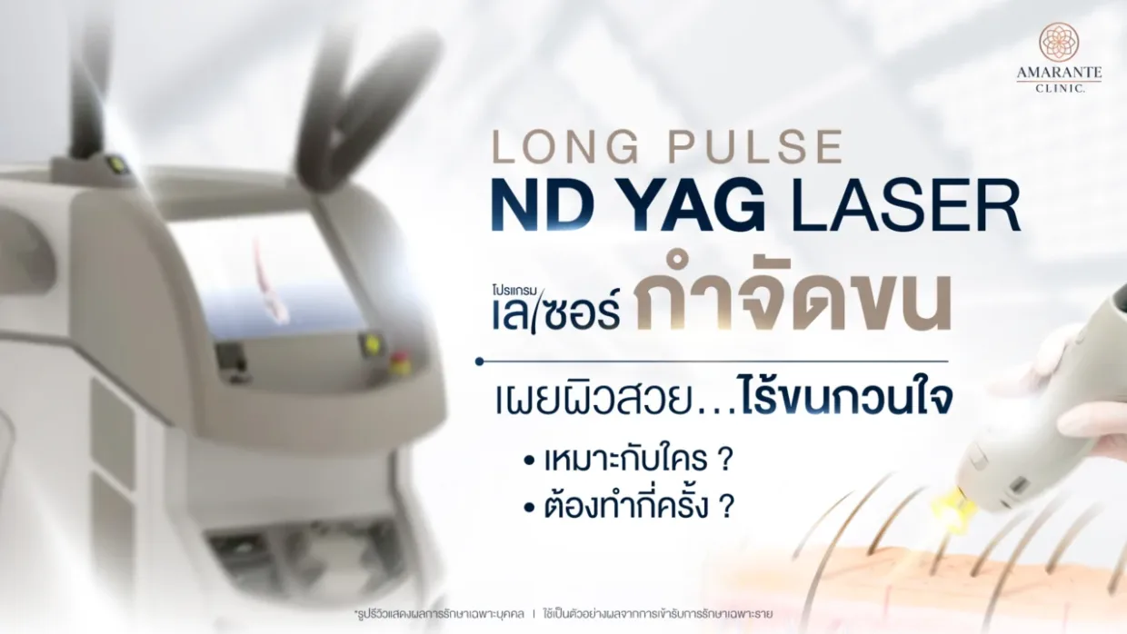 Long Pulse ND Yag คืออะไร? เลเซอร์กำจัดขนส่วนไหนได้บ้าง