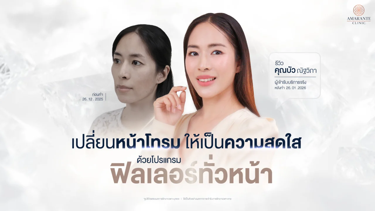 รีวิวฟิลเลอร์ทั่วหน้า คุณบัว ณัฐวิภา เปลี่ยนหน้าโทรม เป็นความสดใส