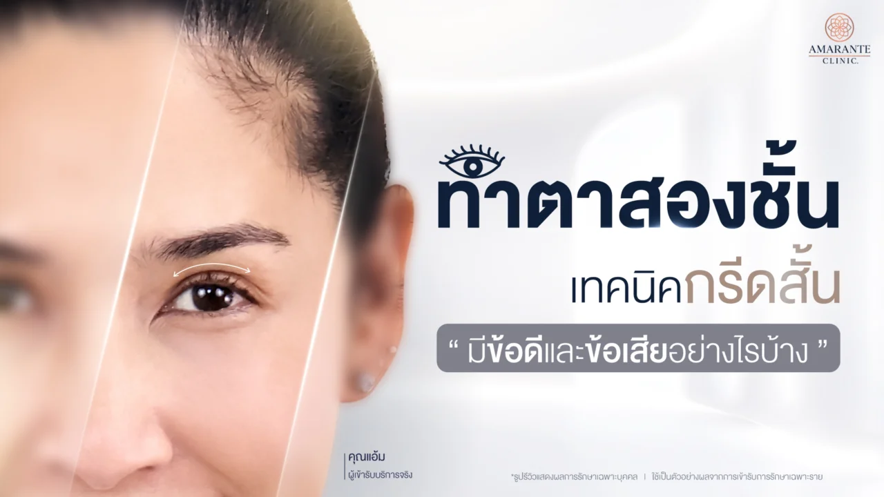 ตาสองชั้นกรีดสั้น เหมาะกับใคร ? รวมข้อดีและข้อเสียที่ควรรู้