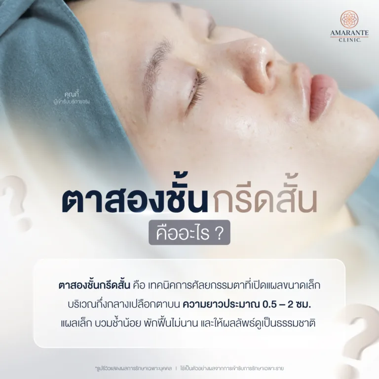ตาสองชั้นกรีดสั้น คืออะไร