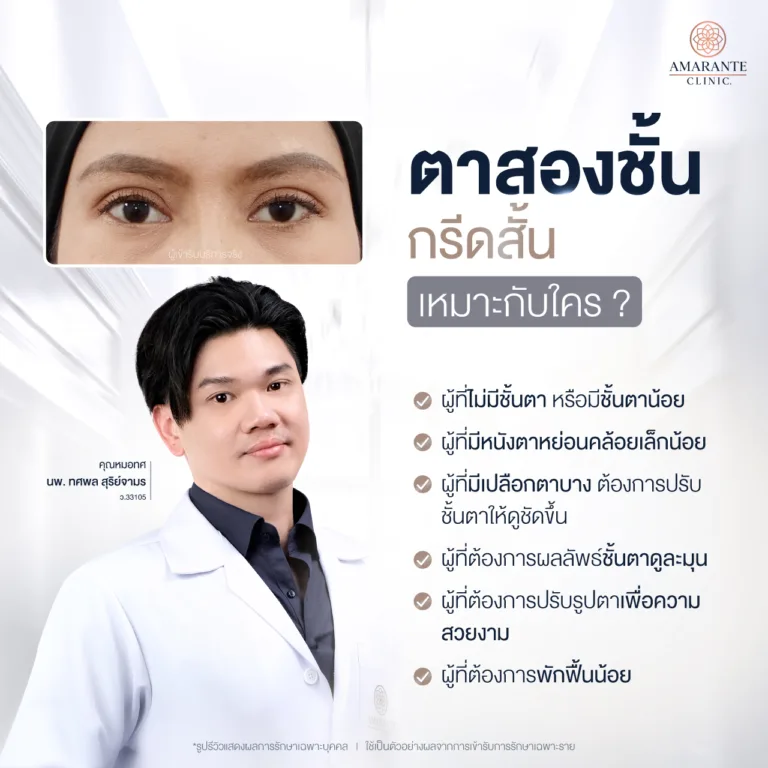 ตาสองชั้นกรีดสั้น เหมาะกับใคร