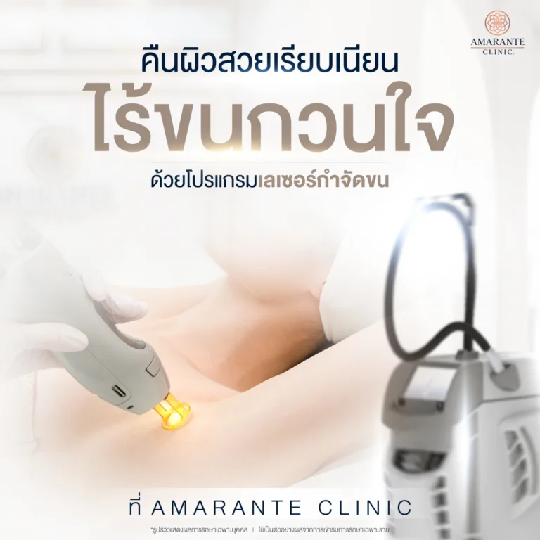ทำ Long Pulse ND YAG Laserที่ Amarante Clinic
