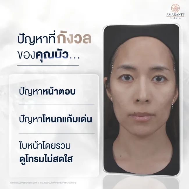 ปัญหาก่อนฉีดฟิลเลอร์