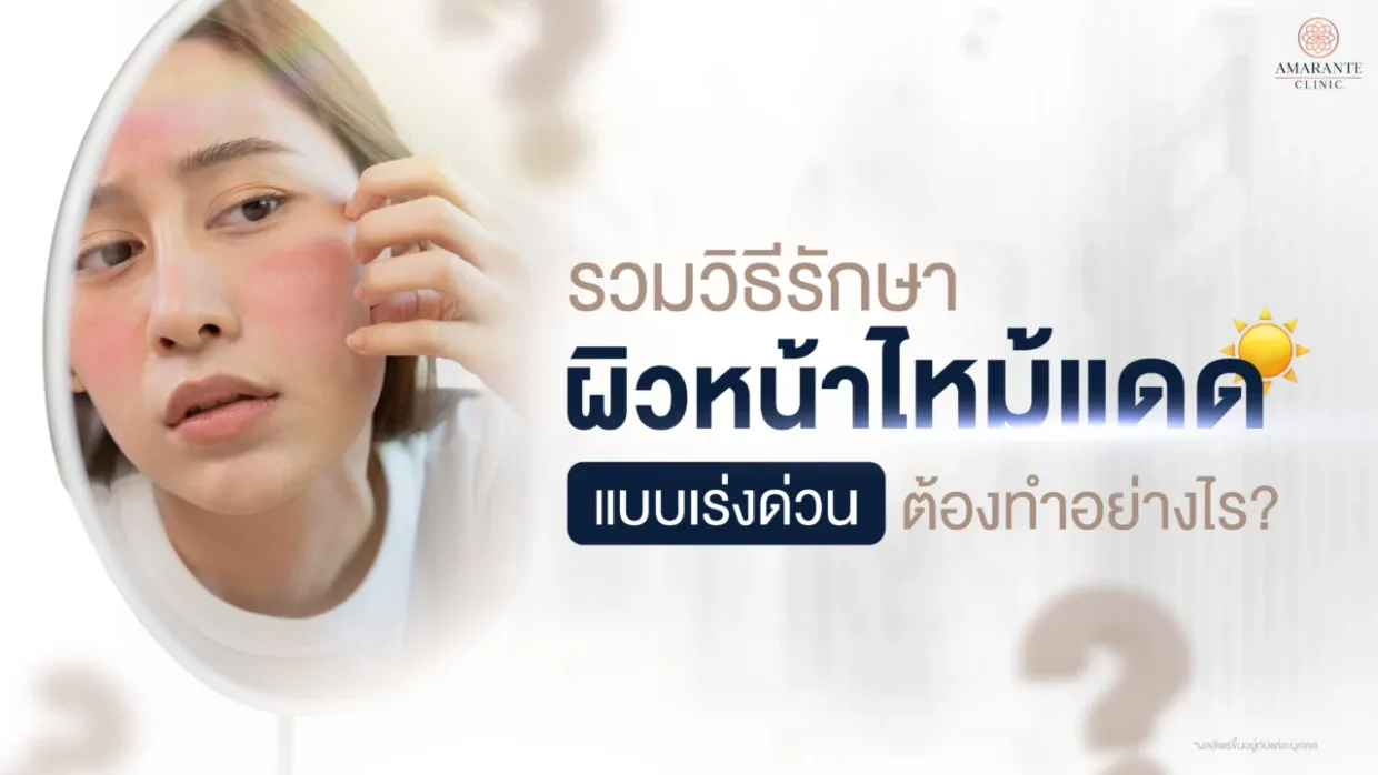 ผิวหน้าไหม้แดด วิธีแก้หน้าไหม้แดดแบบเร่งด่วนทำอย่างไร ?