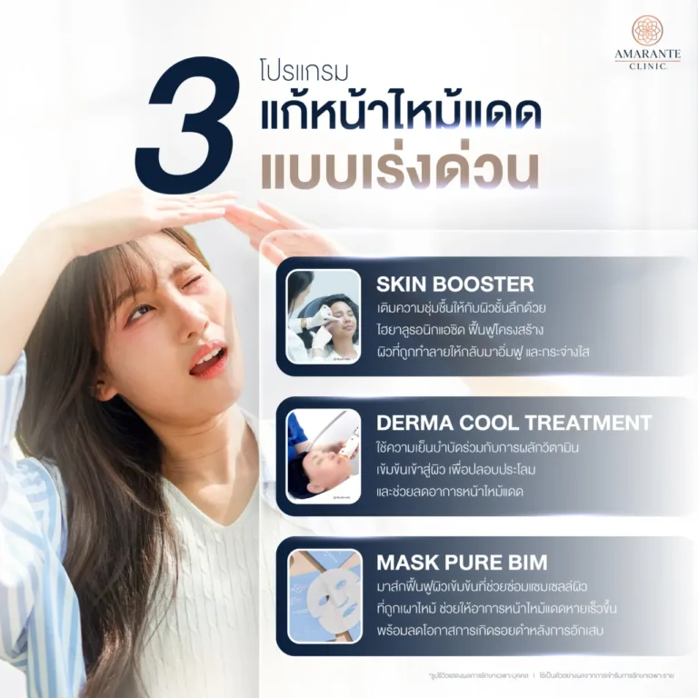 วิธีแก้หน้าไหม้แดดแบบเร่งด่วน