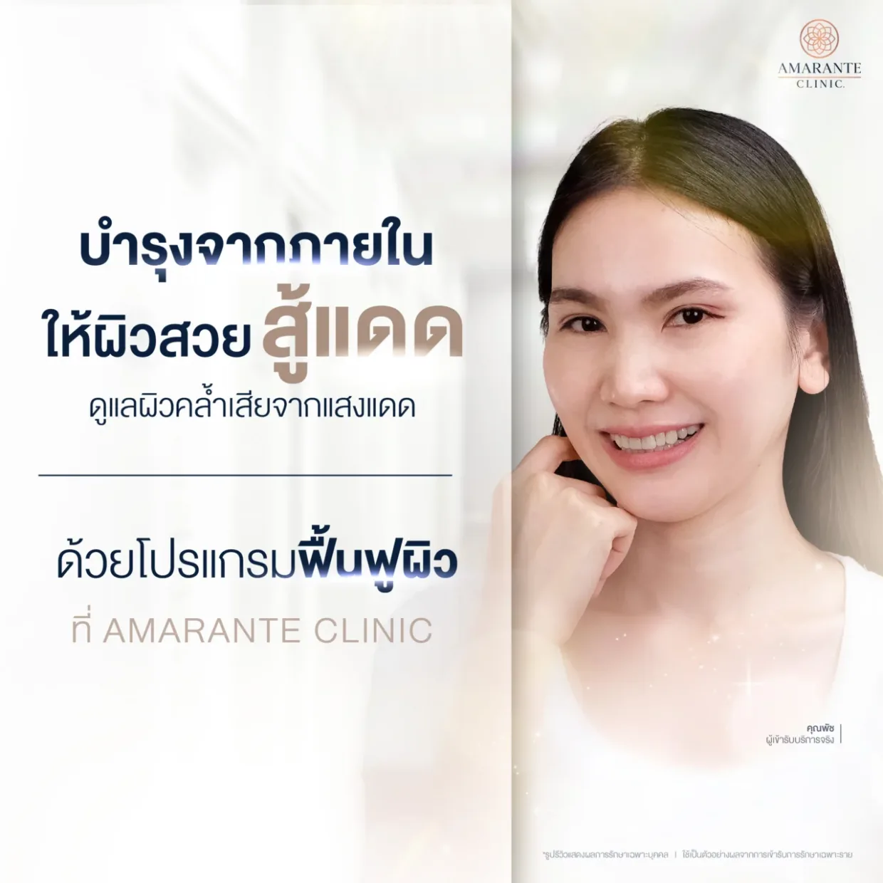 โปรแกรมแก้หน้าไหม้ที่ Amarante Clinic