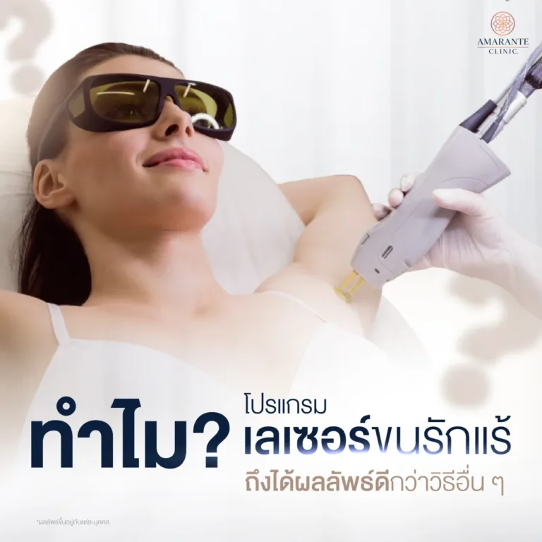 H2 เลเซอร์รักแร้ คืออะไร ?