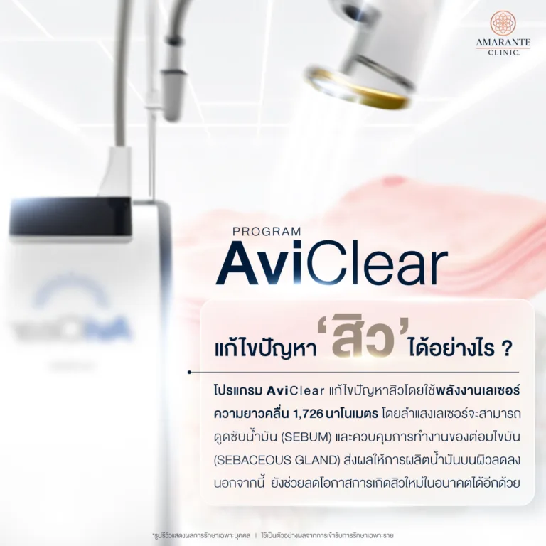 Aviclear แก้ไขปัญหาสิวได้อย่างไร