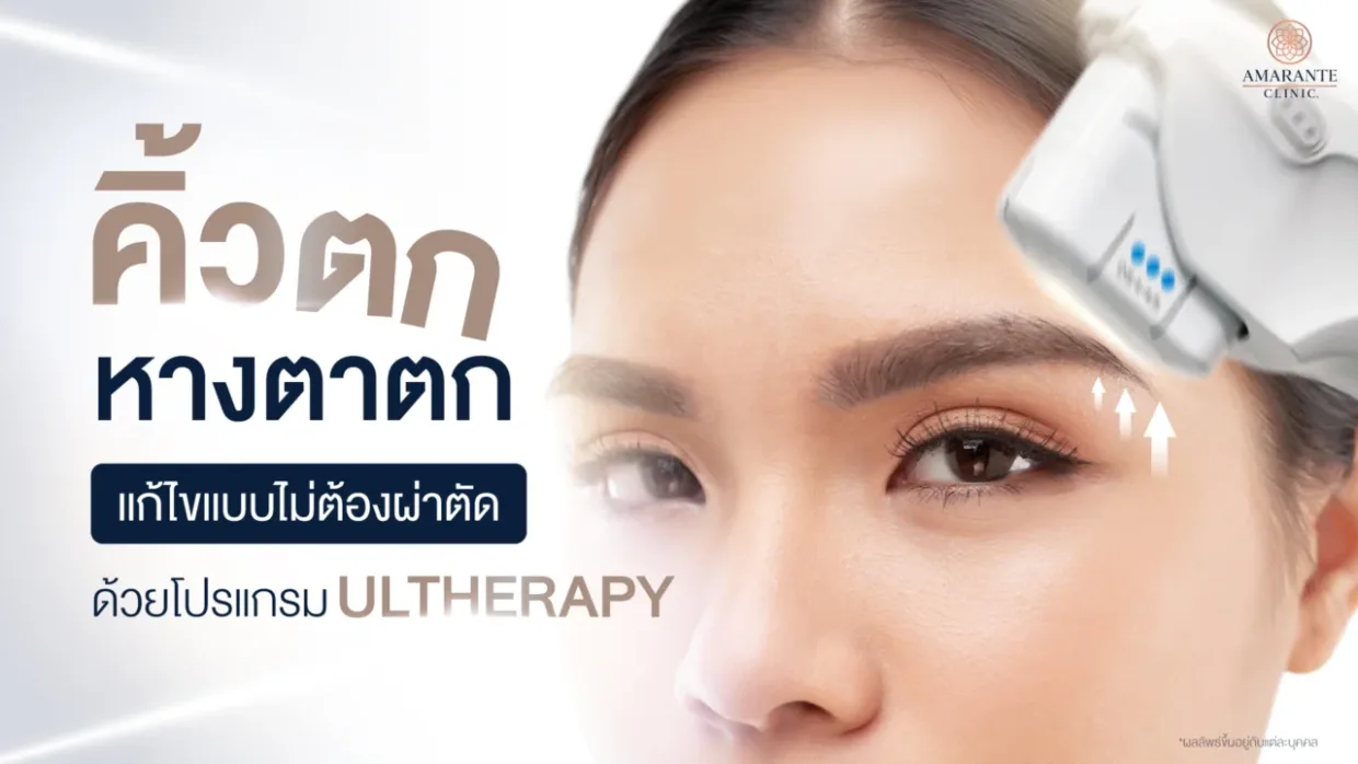 คิ้วตก ยกหางคิ้วแบบไม่ต้องผ่าตัดด้วยโปรแกรม Ulthera