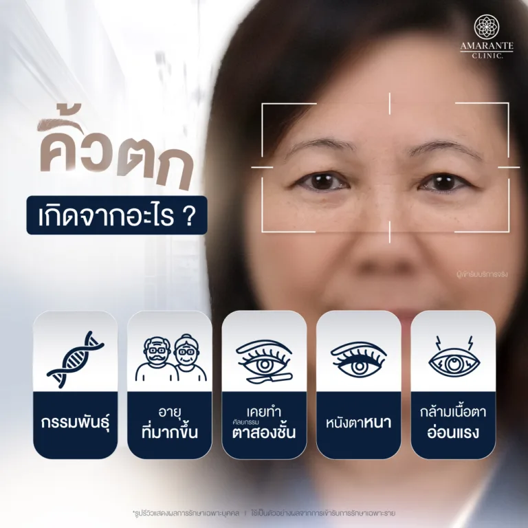 คิ้วตก เกิดจากอะไร?