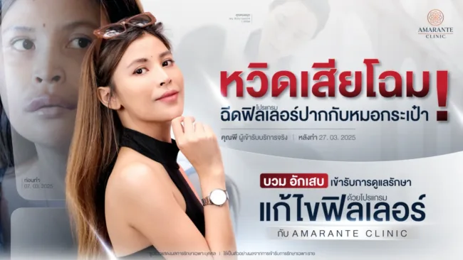 คุณพี หวิดเสียโฉม ฉีดฟิลเลอร์ปากกับหมอกระเป๋า บวม อักเสบ เข้ารับโปรแกรมแก้ไขฟิลเลอร์ กับ Amarante Clinic