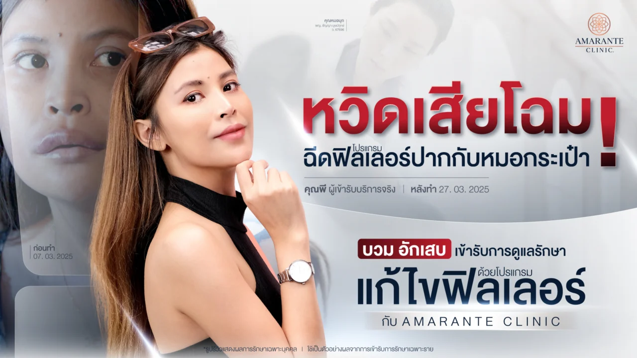 คุณพี หวิดเสียโฉม ฉีดฟิลเลอร์ปากกับหมอกระเป๋า บวม อักเสบ เข้ารับโปรแกรมแก้ไขฟิลเลอร์ กับ Amarante Clinic