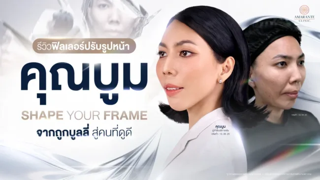 รีวิวฟิลเลอร์ปรับรูปหน้า คุณบูม shape your frame จากถูกบูลลี่ สู่คนที่ดูดี