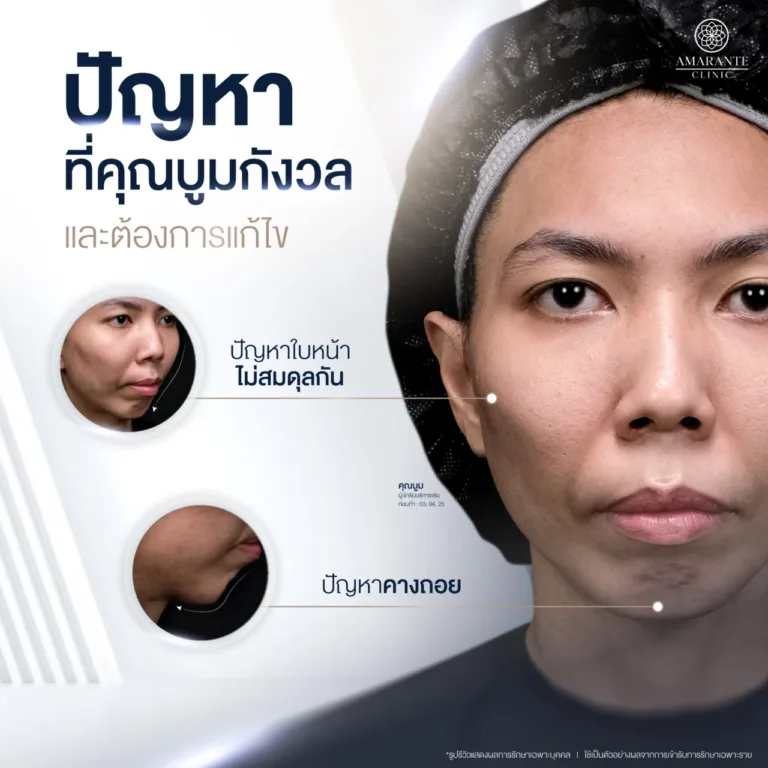 โดนสังคมตัดสิน ไร้ความมั่นใจ ปัญหาทั้งหมดของคุณบูม