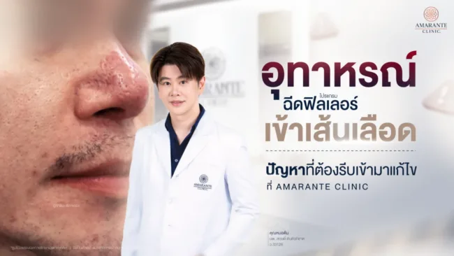 แก้ปัญหาฉีดฟิลเลอร์เข้าเส้นเลือด