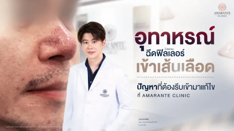 แก้ปัญหาฉีดฟิลเลอร์เข้าเส้นเลือด