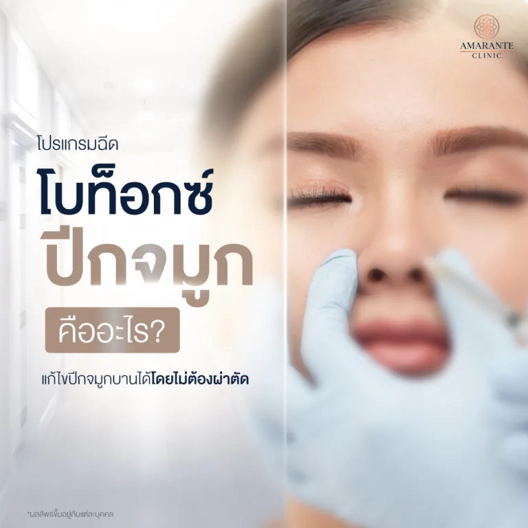 โปรแกรมฉีดโบท็อกซ์ปีกจมูก แก้ไจปีกจมูกบานโดยไม่ต้องผ่าตัด