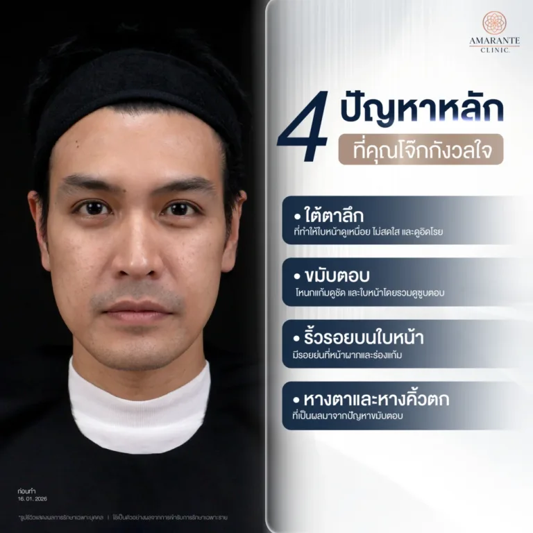 ปัญหาถุงใต้ตาของคุณโจ๊ก ภูริช ก่อนฉีดฟิลเลอร์ใต้ตา