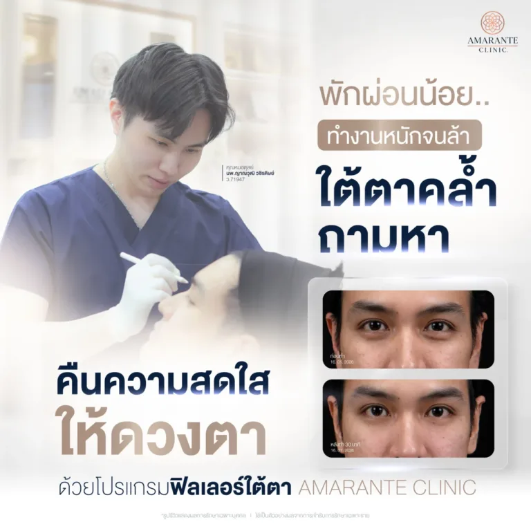 คุณโจ๊ก ภูริช เลือกฉีดฟิลเลอร์ใต้ตาที่ Amarante Clinic