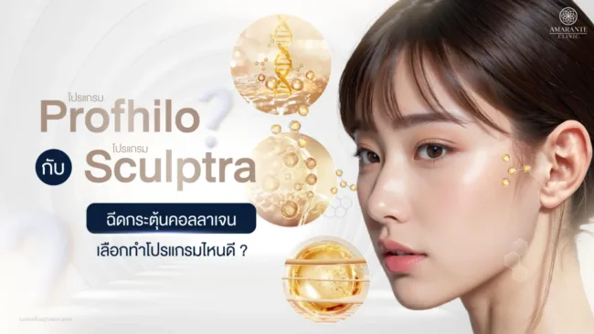 ฉีดกระตุ้นคอลลาเจน Profhilo vs Sculptra