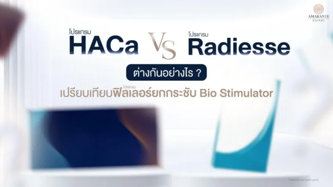HarmonyCa vs Radiesse