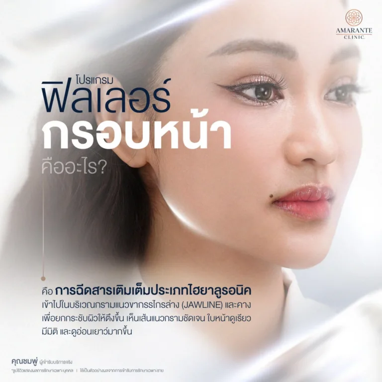 ฟิลเลอร์กรอบหน้า (Jawline Filler) คืออะไร?