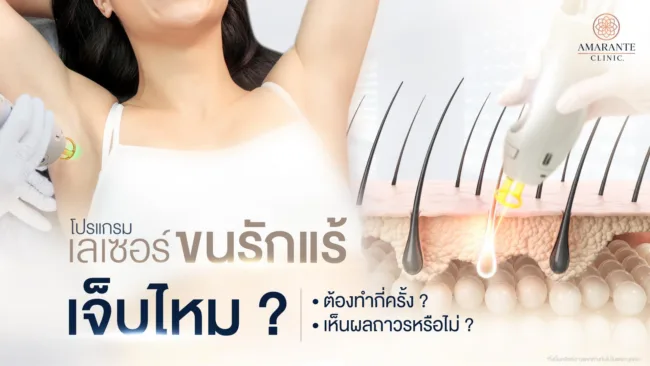 เลเซอร์ขนรักแร้ เจ็บไหม