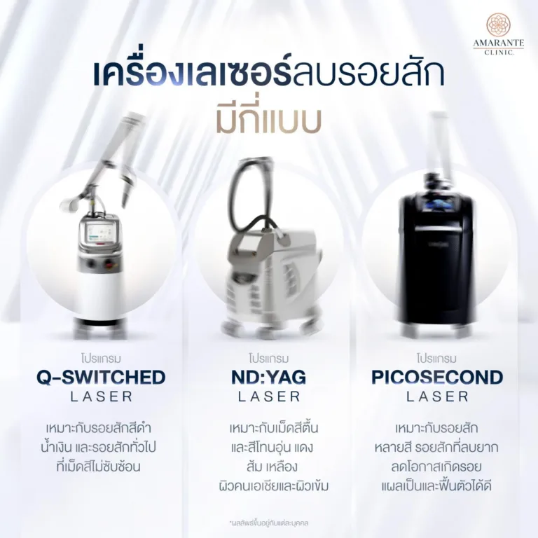 เครื่องเลเซอร์ลบรอยสัก