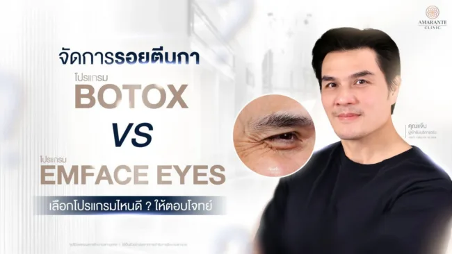 วิธีลดรอยตีนกา แบบไหนดี