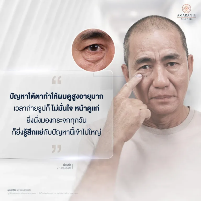 ปัญหาก่อนมาผ่าตัดถุงใต้ตา