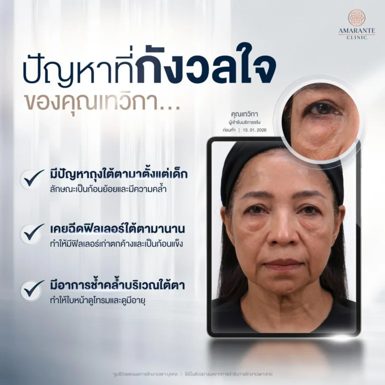 ทำไมต้องผ่าตัดถุงใต้ตา