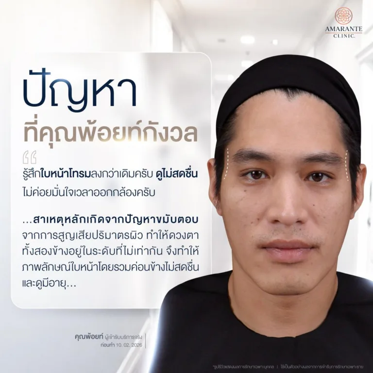 ปัญหาก่อนฉีดฟิลเลอร์ขมับ