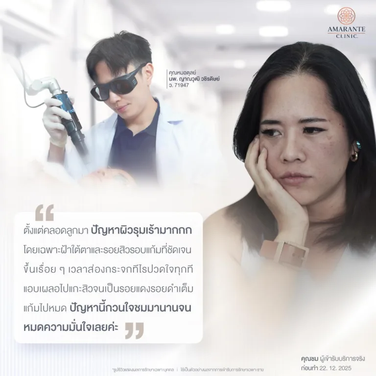 ปัญหาการรักษาฝ้าของคุณชม