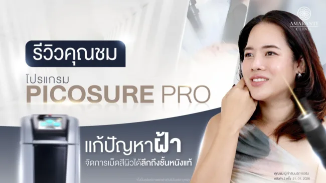รีวิวรักษาฝ้าด้วย Pico Laser