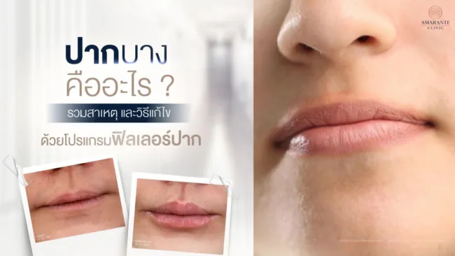 ปากบางคืออะไร ?