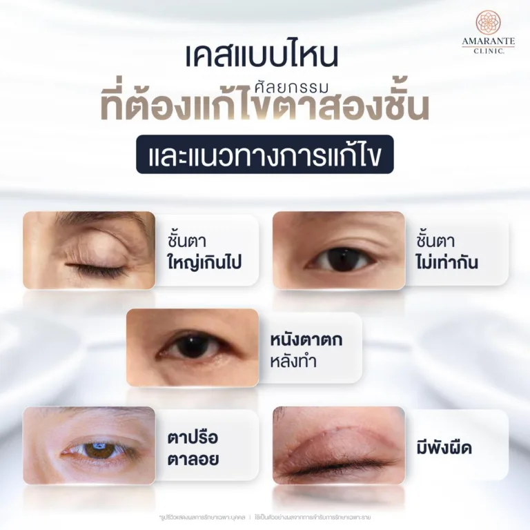 เคสแบบไหนที่ต้องแก้ตาสองชั้น