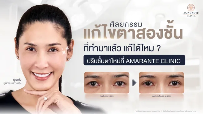 แก้ตาสองชั้นได้ไหม