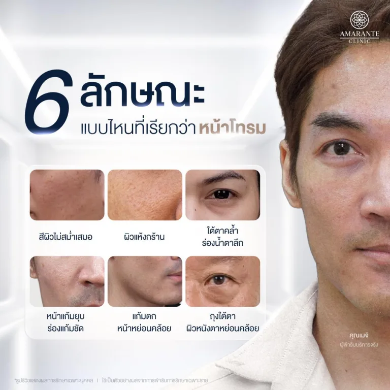 ลักษณะหน้าโทรม