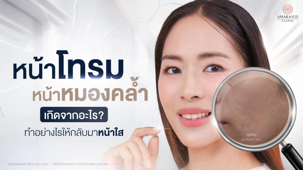 หน้าโทรม หน้าหมองคล้ำ เกิดจากอะไร?