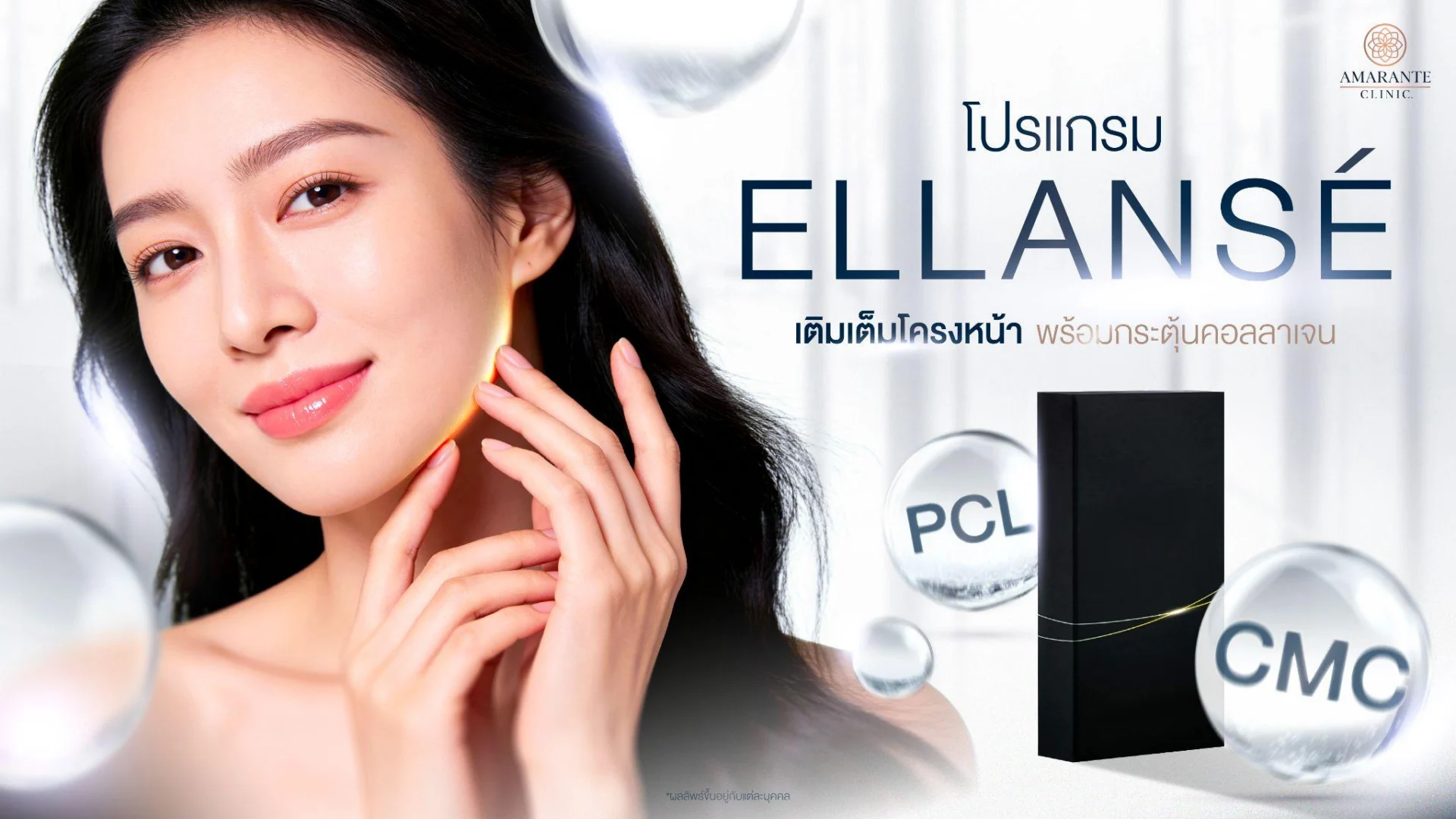 ฉีด Ellanse
