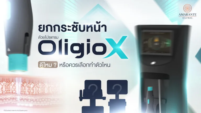 ยกกระชับหน้าด้วย Oligio X