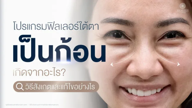 ฟิลเลอร์ใต้ตาเป็นก้อน