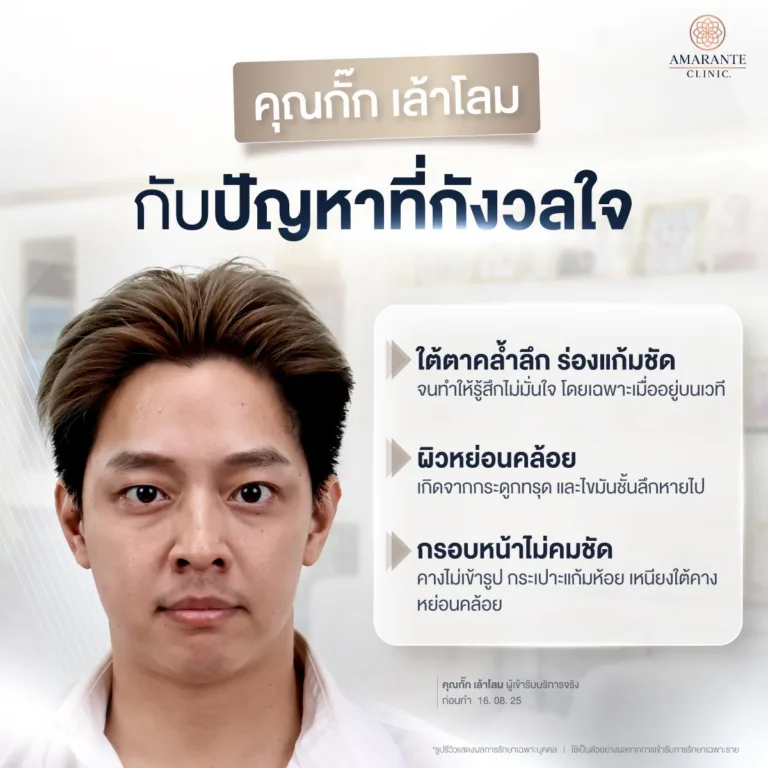 ปัญหาหน้าโทรม ของ กั๊ก เล้าโลม