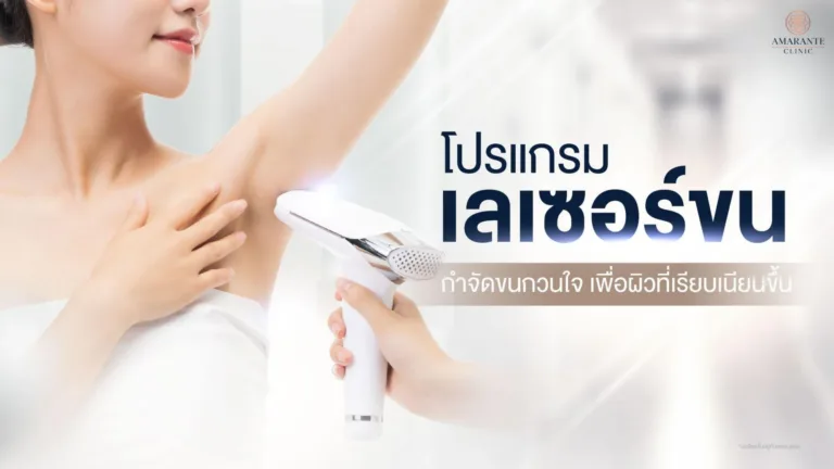 เลเซอร์กำจัดขนกวนใจ