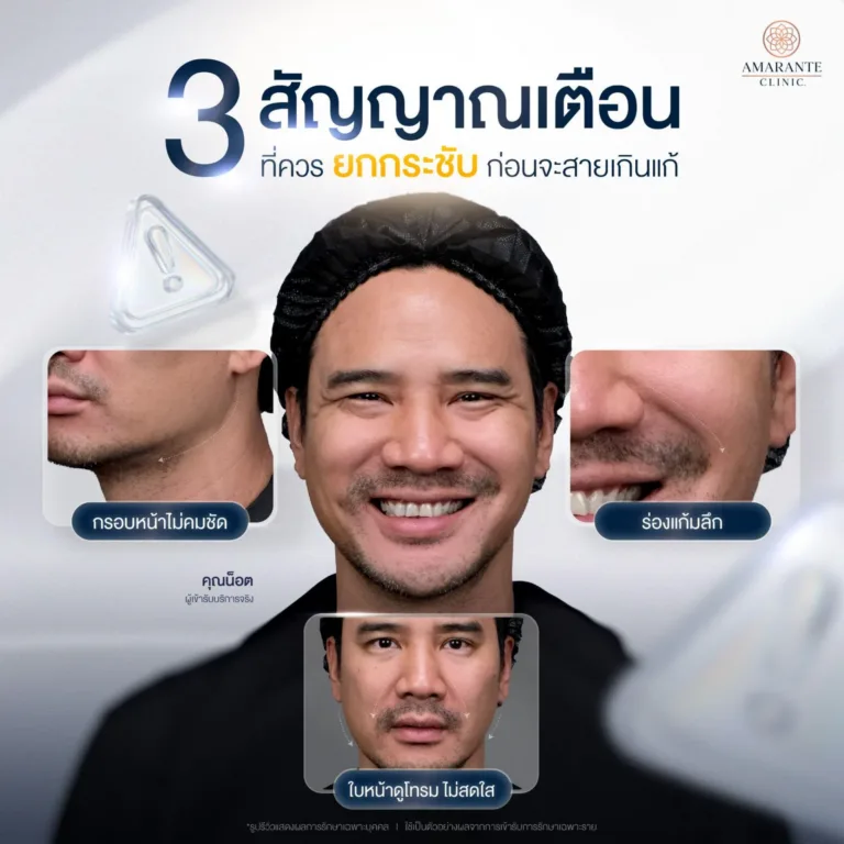 3 สัญญาณ ถึงเวลายกกระชับหน้าด้วย Ulthera Prime