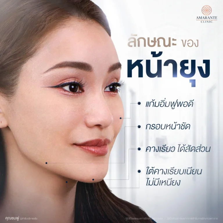 ลักษณะหน้ายุง