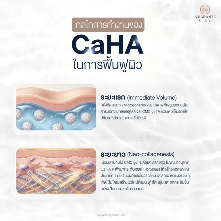 CaHA คืออะไร? ช่วยเรื่องอะไร