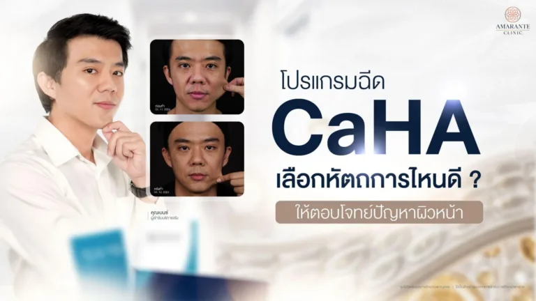ฉีด CaHA เลือกตัวไหน