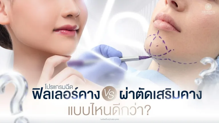 ฉีดฟิลเลอร์คาง vs ผ่าตัดเสริมคาง
