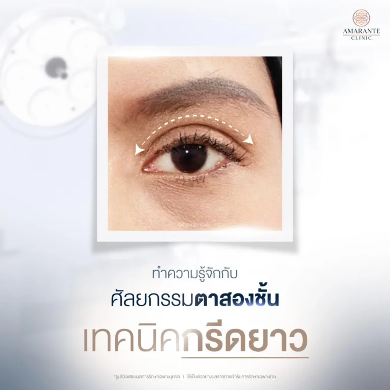 ทำตาสองชั้นแบบกรีดยาว